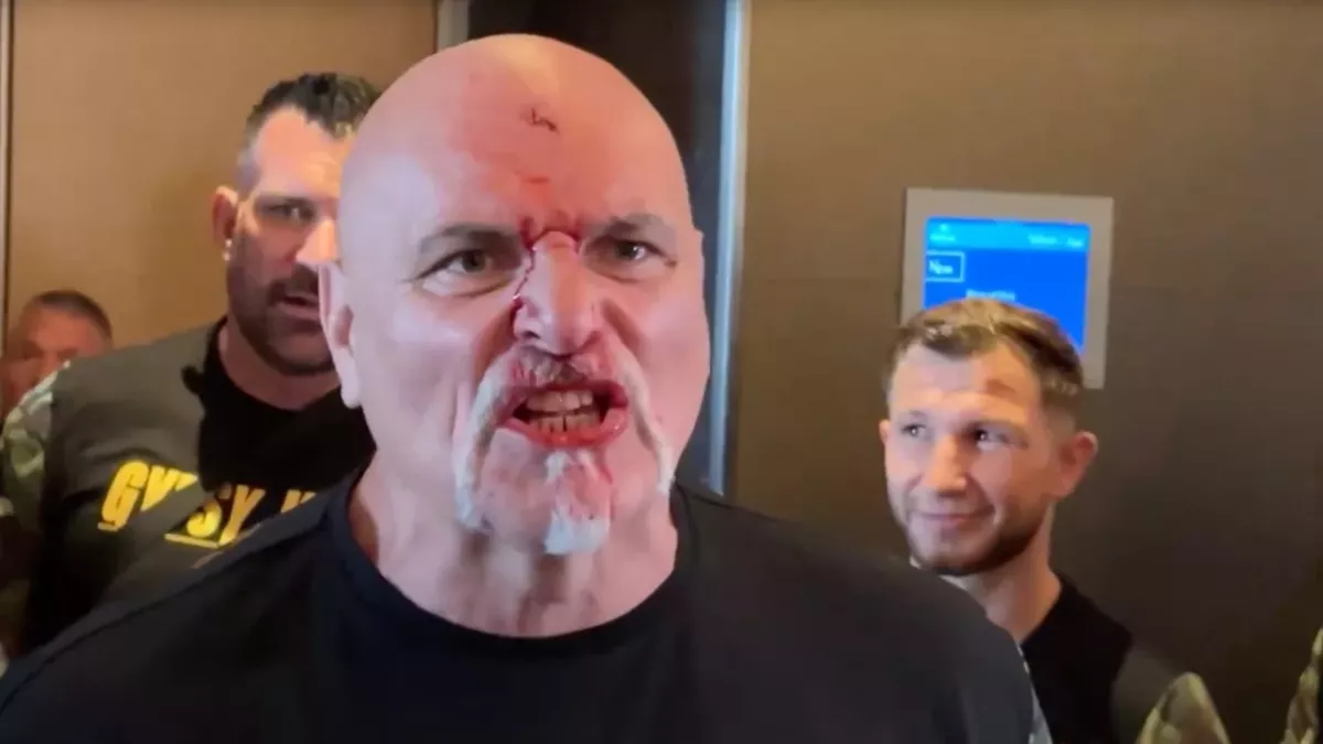 John Fury en sang après son coup de tête 