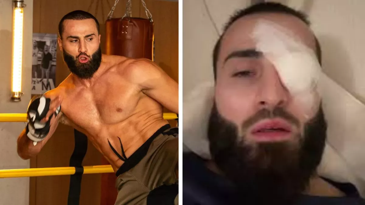 IbraTV s'est gravement blessé à l'oeil avant ses débuts en MMA.