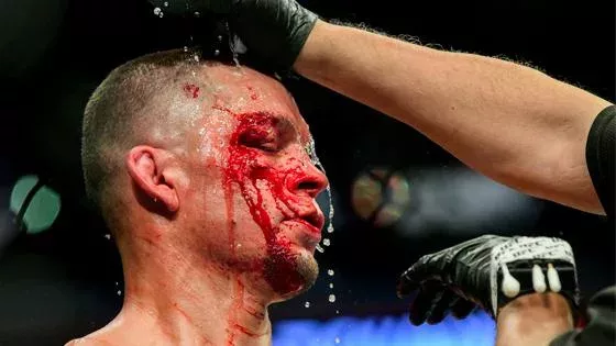 UFC 244 : Nate Diaz