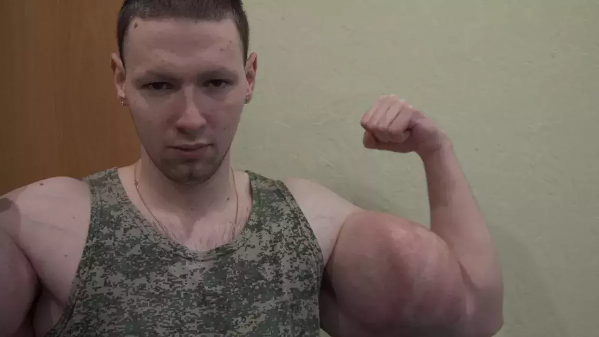 Le Synthol Kid s'est remis de ses opérations au bras et croque la vie à pleine dent