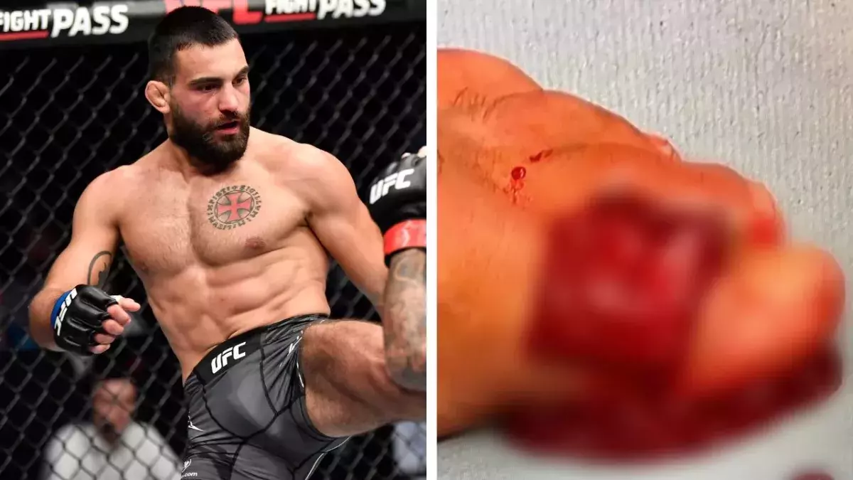 Benoit Saint-Denis s'est blessé au pied à l'UFC Paris