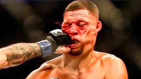 Nate Diaz