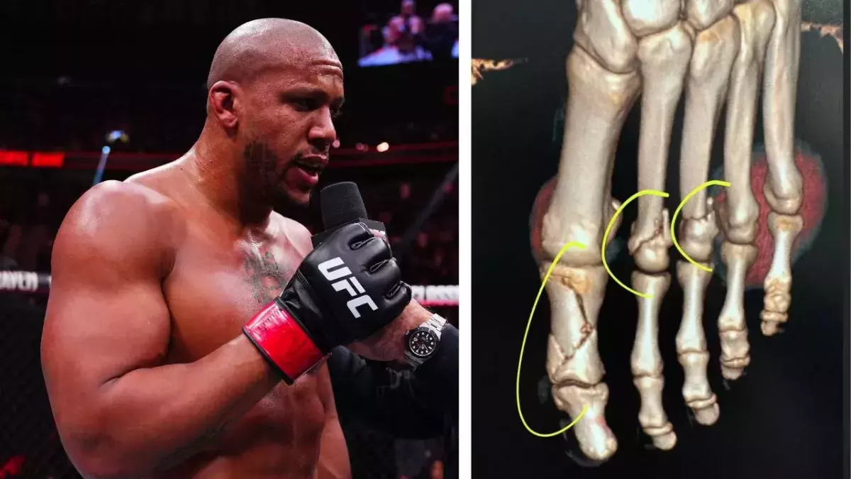 La blessure subie par Ciryl Gane lors de son combat contre Volkov est plus importante que prévu. 