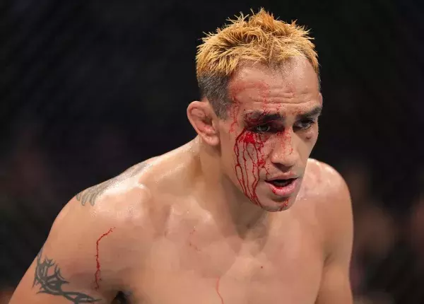 Tony Ferguson